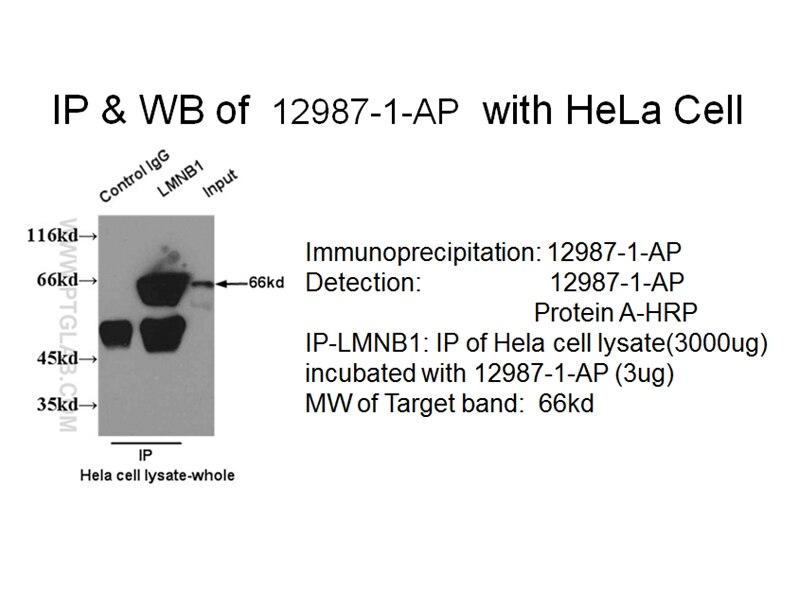 LMNB1 IP 12987-1-AP LMNB1 Antibody ADLD; LMN; LMN2; LMNB; MGC111419