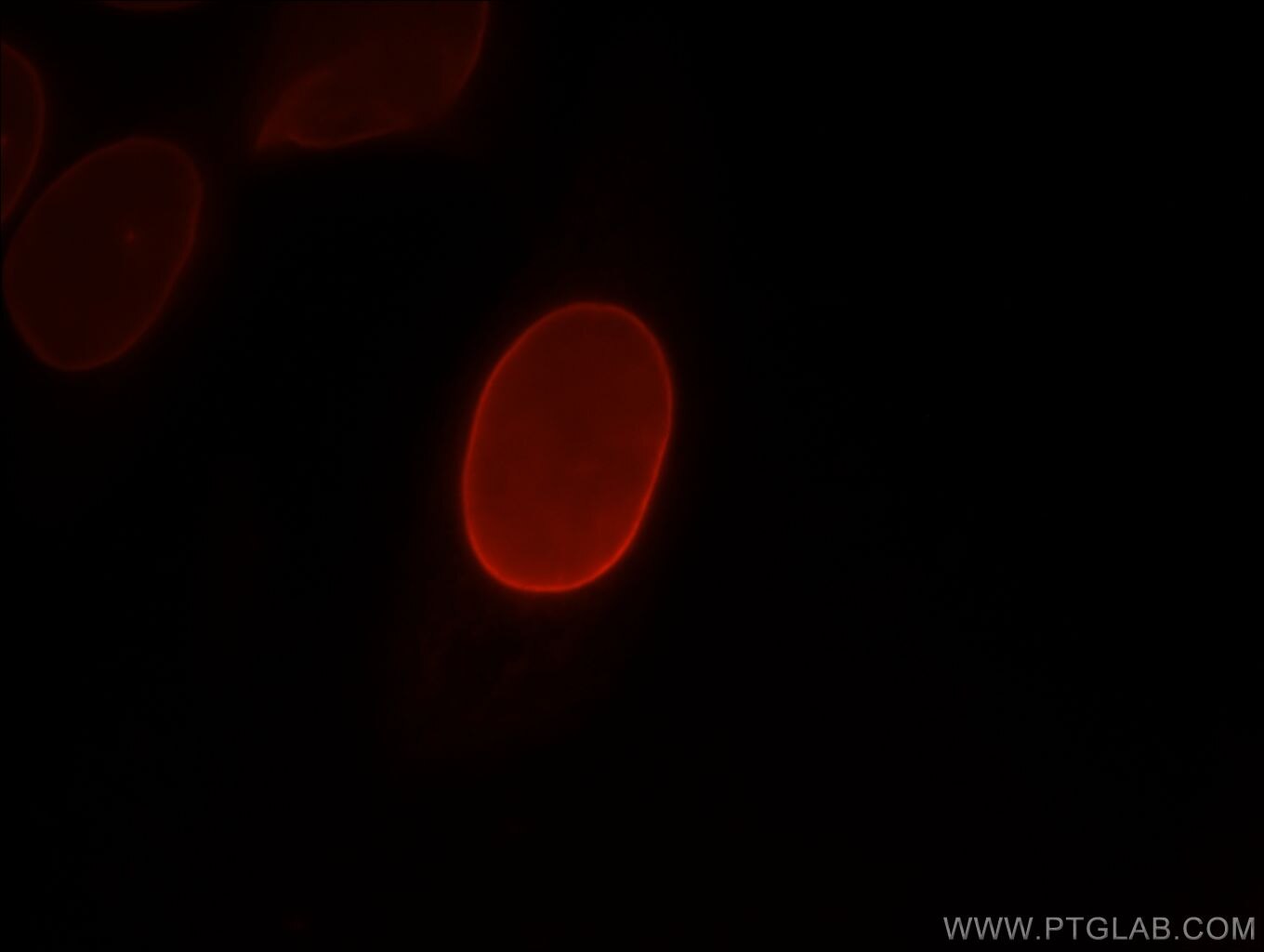 LMNB1 Immunofluorescence IF 12987-1-AP LMNB1 Antibody ADLD; LMN; LMN2; LMNB; MGC111419
