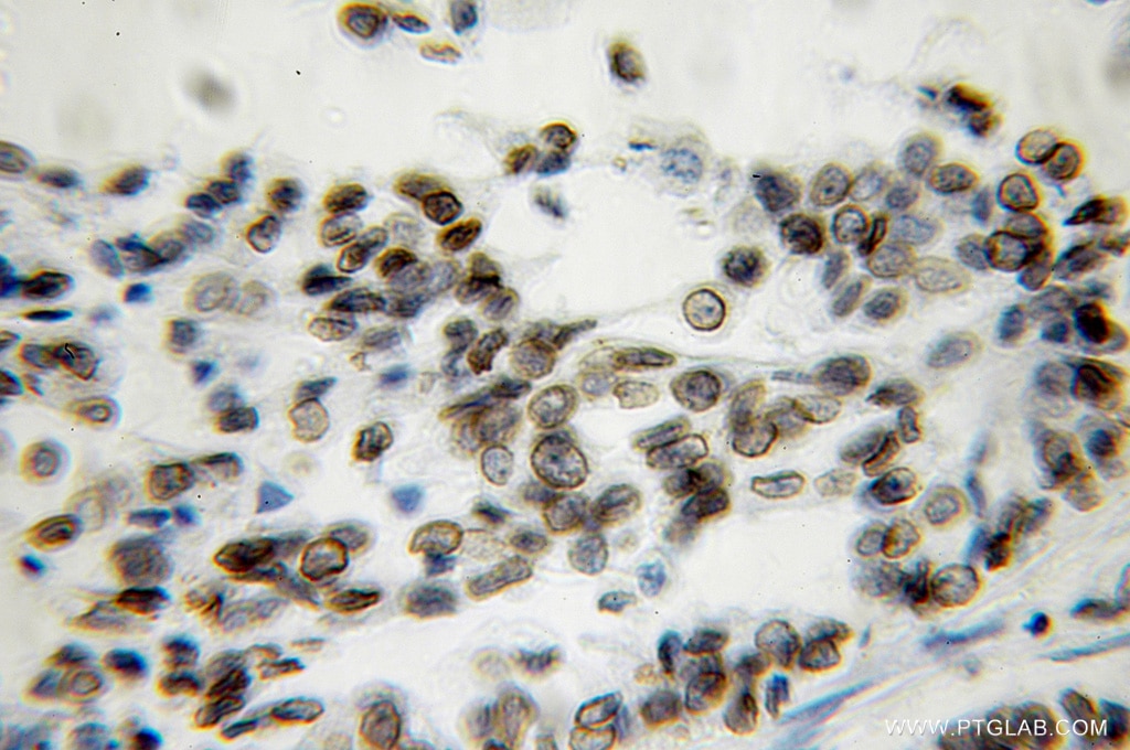 LMNB1 IHC Immunohistochemical 12987-1-AP LMNB1 Antibody ADLD; LMN; LMN2; LMNB; MGC111419