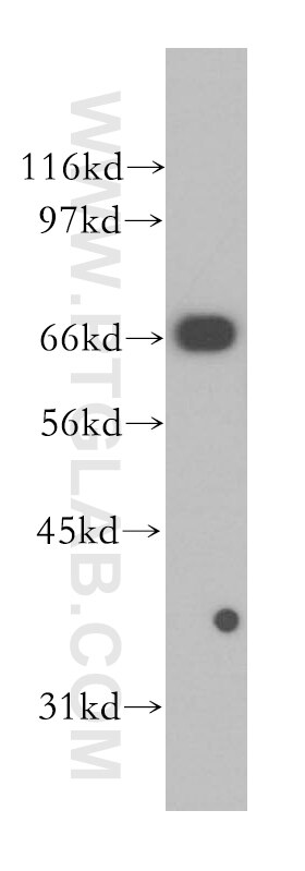 LMNB1 western blot WB 12987-1-AP LMNB1 Antibody ADLD; LMN; LMN2; LMNB; MGC111419