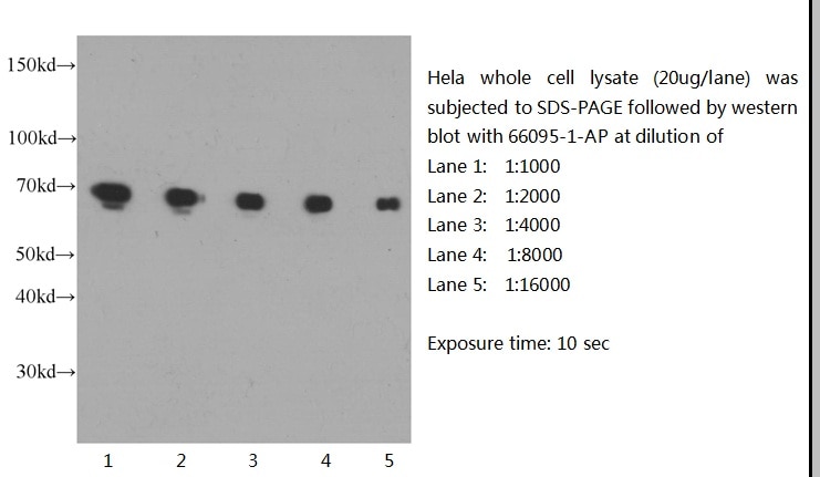 LMNB1 WB 66095-1-Ig LMNB1 Antibody ADLD; LMN; LMN2; LMNB; MGC111419