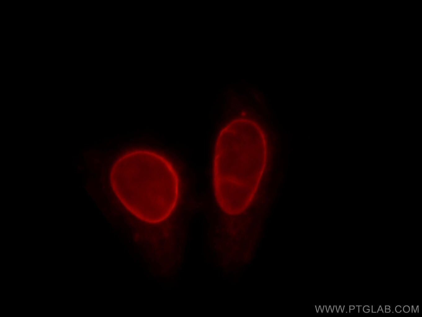 LMNB1 Immunofluorescence IF 66095-1-Ig LMNB1 Antibody ADLD; LMN; LMN2; LMNB; MGC111419