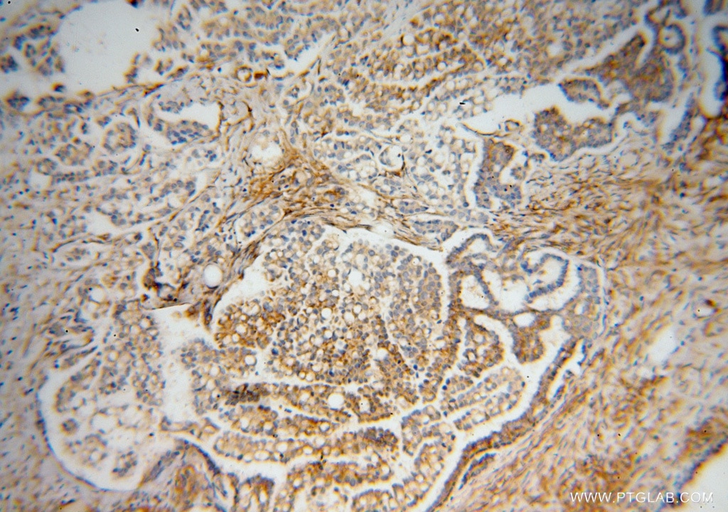 LMOD1 IHC Immunohistochemical 15117-1-AP LMOD1 Antibody 1D; 64kD; D1; FLJ55689; SM-LMOD