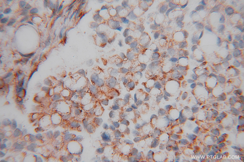 LMOD1 IHC Immunohistochemical 15117-1-AP LMOD1 Antibody 1D; 64kD; D1; FLJ55689; SM-LMOD