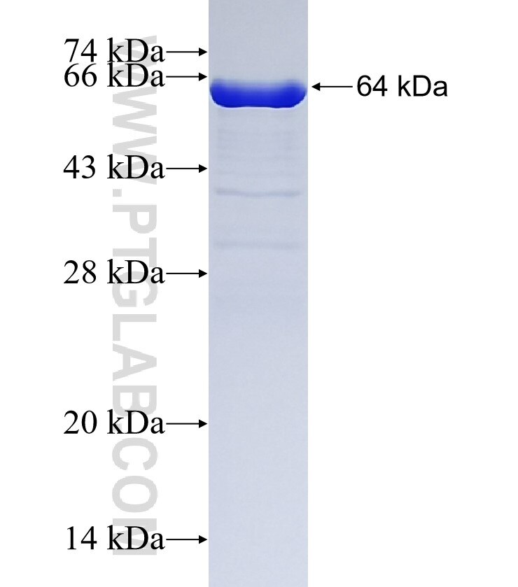 LPCAT1 fusion protein ag9035 SDS-PAGE