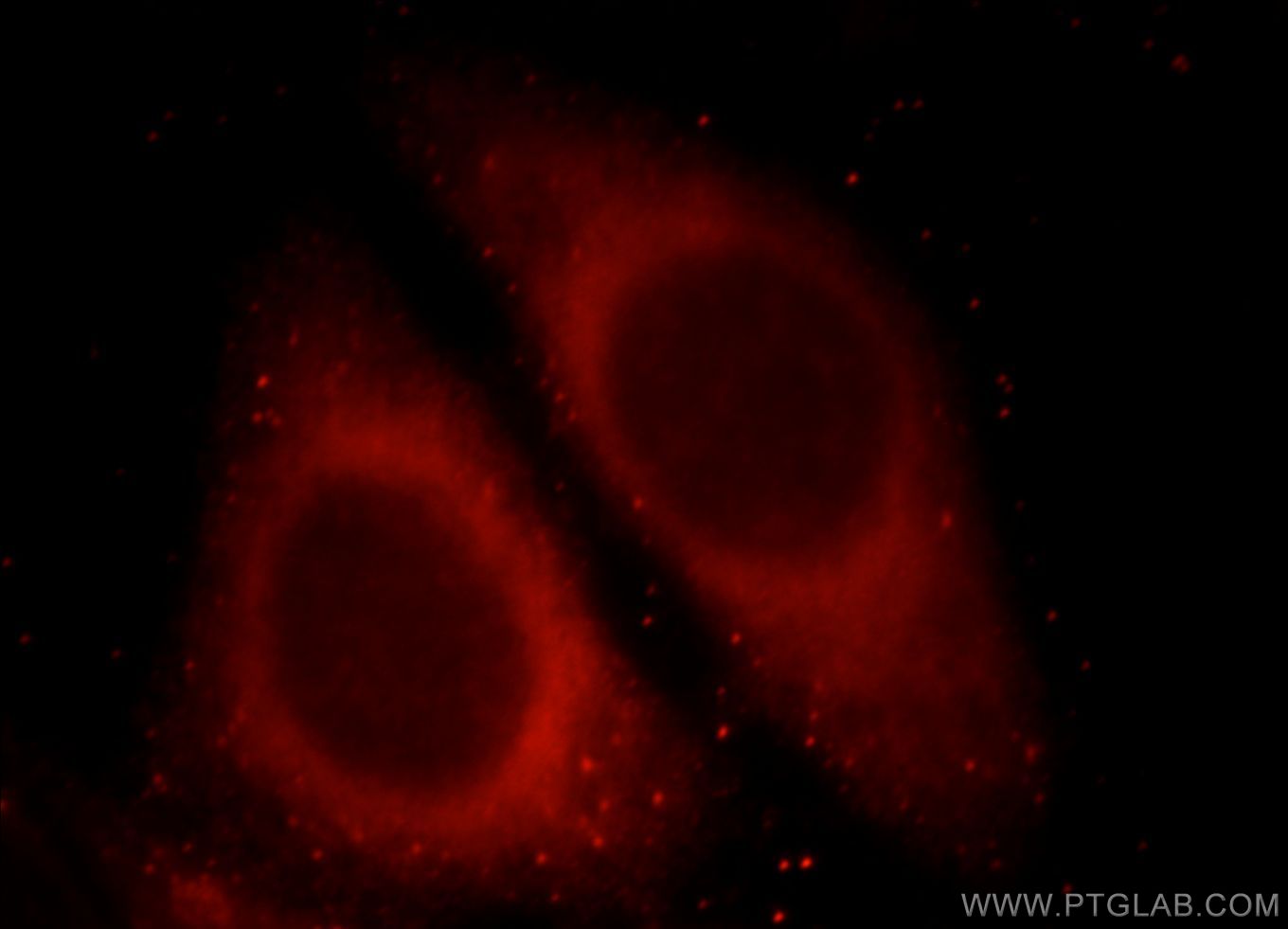 Immunofluorescent analysis of HepG2 cells, using LRRC8C antibody 21601-1-AP at 1:25 dilution and Rhodamine-labeled goat anti-rabbit IgG (red). LRRC8C Immunofluorescence IF 21601-1-AP LRRC8C Antibody AD158; DKFZp586J1119; FAD158; MGC138551