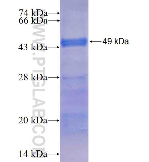 LRRK1 fusion protein ag7786 SDS-PAGE