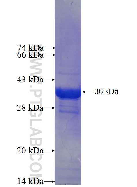 LSM8 fusion protein ag0178 SDS-PAGE