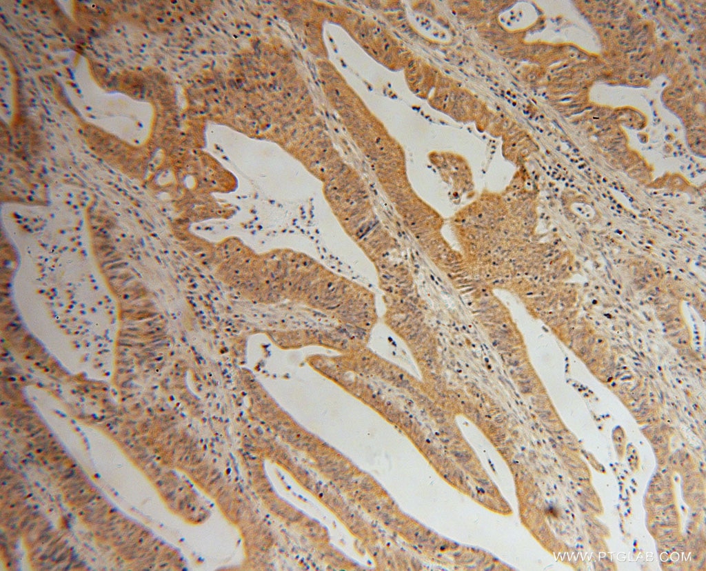 LYPLA1 IHC Immunohistochemical 16055-1-AP LYPLA1 Antibody APT-1; LPL1; LYSOPLA