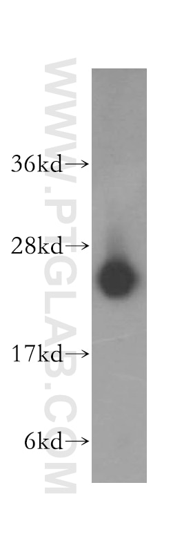 LYPLA1 western blot WB 16055-1-AP LYPLA1 Antibody APT-1; LPL1; LYSOPLA