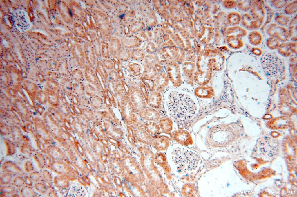 LYPLAL1 IHC Immunohistochemical 16146-1-AP LYPLAL1 Antibody FLJ99730; KIAA1238