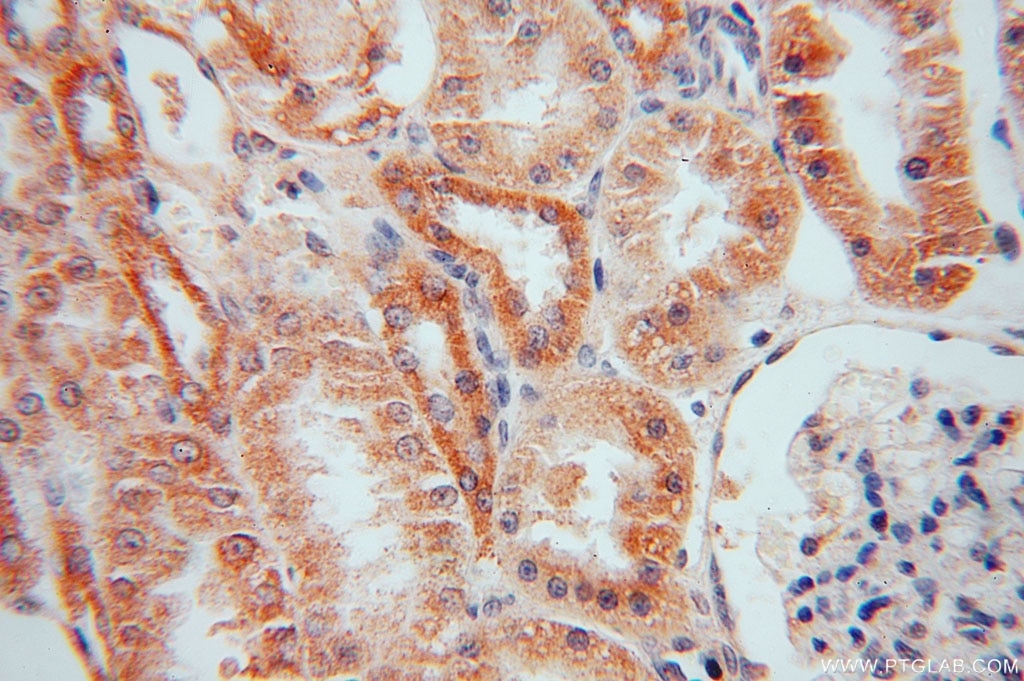 LYPLAL1 IHC Immunohistochemical 16146-1-AP LYPLAL1 Antibody FLJ99730; KIAA1238
