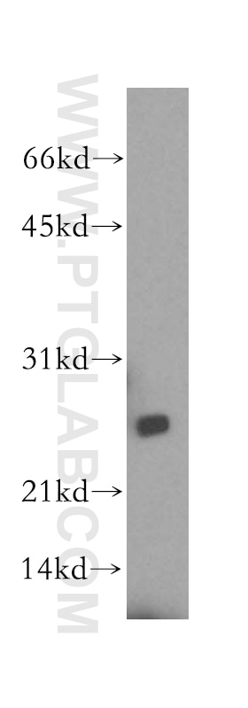 LYPLAL1 western blot WB 16146-1-AP LYPLAL1 Antibody FLJ99730; KIAA1238