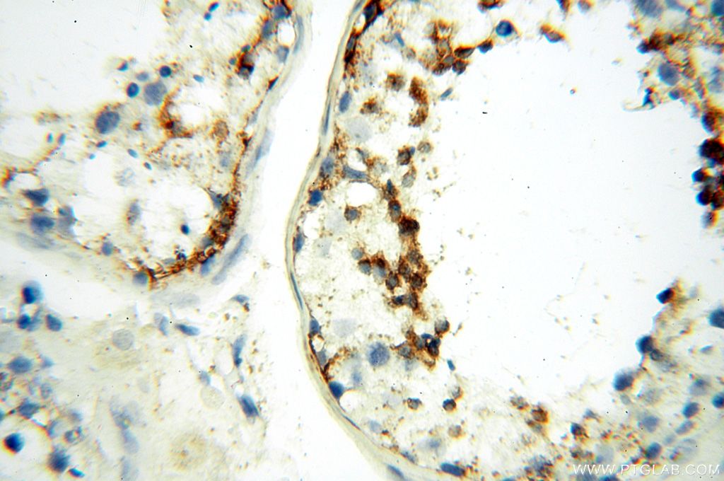 LYZL1 IHC Immunohistochemical 17207-1-AP LYZL1 Antibody KAAG648; LYC2; MGC33408; PRO1278; bA534G20.1