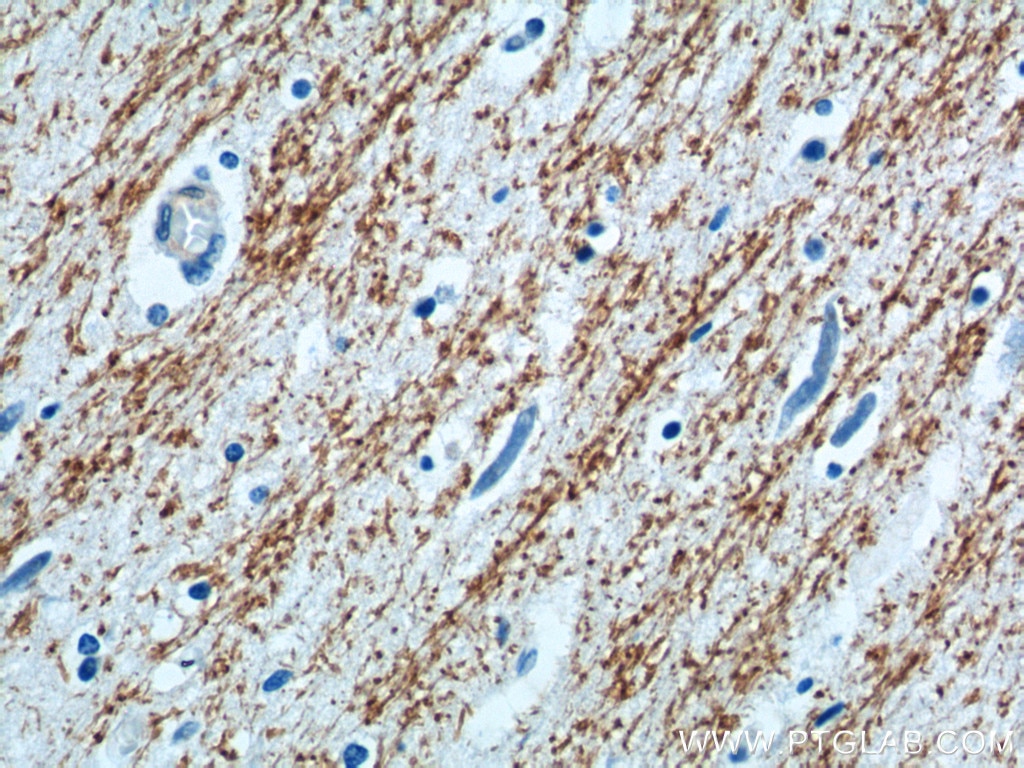 Myelin Associated Glycoprotein Antibodies