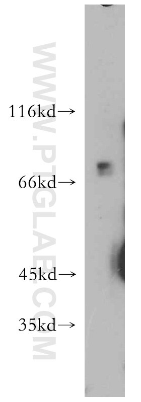 A375 cells were subjected to SDS PAGE followed by western blot with 21491-1-AP(MAGEC3 Antibody) at dilution of 1:600 MAGEC3 western blot WB 21491-1-AP MAGEC3 Antibody CT7.2; HCA2; MAGE-C3; MAGEC4; MGC119270; MGC119271