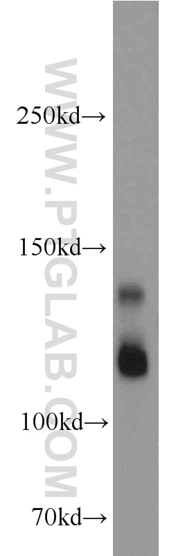 MAP1S western blot WB 15695-1-AP MAP1S Antibody BPY2IP1; C19orf5; FLJ10669; MAP8; MGC133087; VCY2IP-1; VCY2IP1
