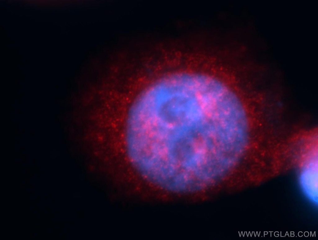 MAP3K11 Immunofluorescence IF 11996-1-AP MAP3K11 Antibody MGC17114; MLK-3; MLK3; PTK1; SPRK