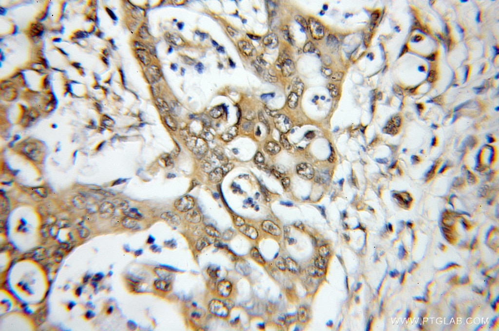 MAP3K11 IHC Immunohistochemical 11996-1-AP MAP3K11 Antibody MGC17114; MLK-3; MLK3; PTK1; SPRK