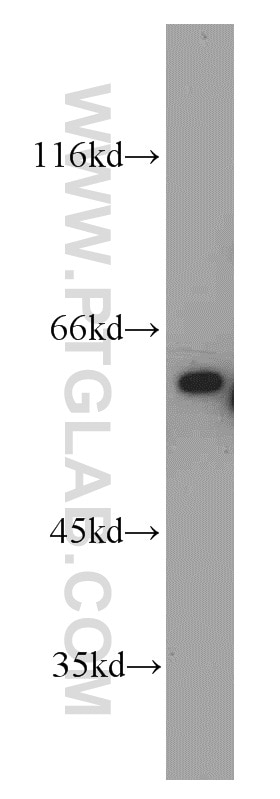 MAP3K11 western blot WB 11996-1-AP MAP3K11 Antibody MGC17114; MLK-3; MLK3; PTK1; SPRK