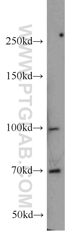 HT-1080 cells were subjected to SDS PAGE followed by western blot with 10274-1-AP(TAU Antibody) at dilution of 1:600 TAU western blot WB 10274-1-AP TAU Antibody DDPAC; FLJ31424; FTDP-17; MAPTL; MGC138549; MSTD; MTBT1; MTBT2; PPND; TAU