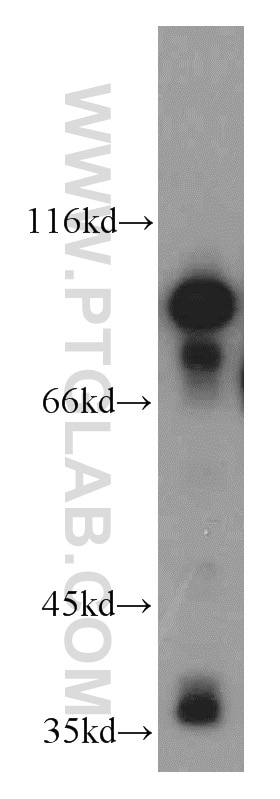 mouse brain tissue were subjected to SDS PAGE followed by western blot with 21552-1-AP(MARK1 Antibody) at dilution of 1:2000 MARK1 western blot WB 21552-1-AP MARK1 Antibody KIAA1477; MARK; MGC126512; MGC126513