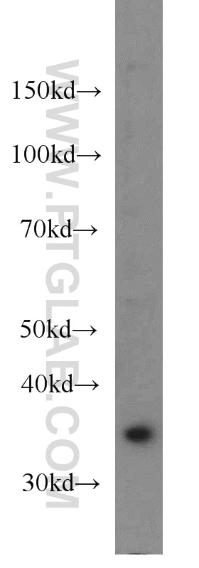 Hela cells were subjected to SDS PAGE followed by western blot with 66026-1-Ig(MCL1 Antibody) at dilution of 1:1000 MCL1 western blot WB 66026-1-Ig MCL1 Antibody BCL2L3; EAT; MCL1L; MCL1S; MGC104264; MGC1839; Mcl-1; TM