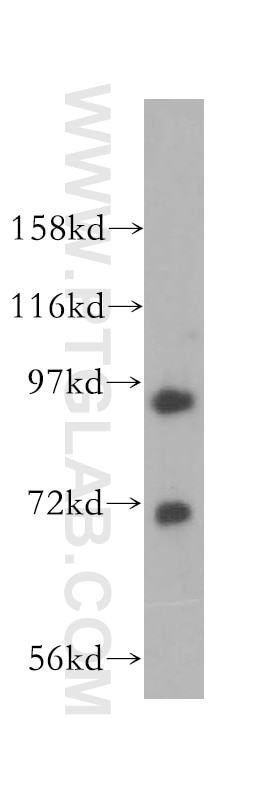 MCM8 western blot WB 16451-1-AP MCM8 Antibody C20orf154; MGC119522; MGC119523; MGC12866; MGC4816; REC; dJ967N21.5