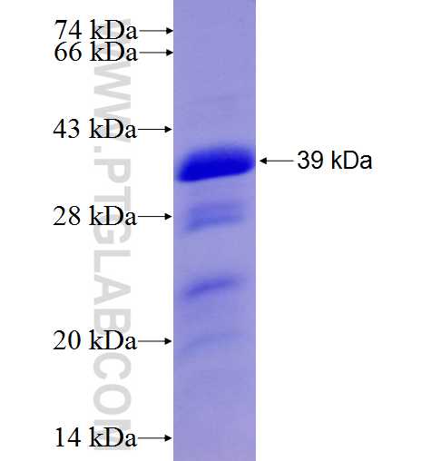 MCSF fusion protein ag6294 SDS-PAGE