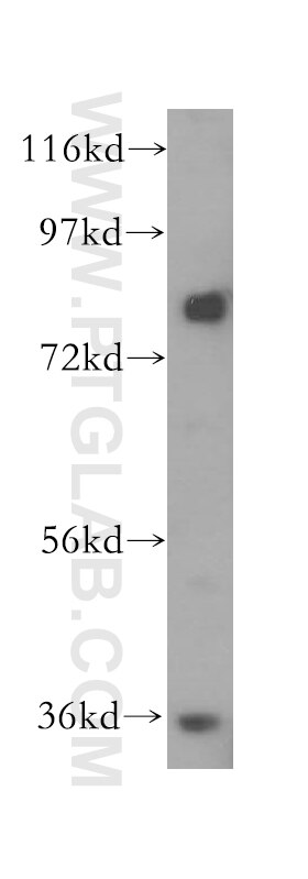 MDM1 western blot WB 17575-1-AP MDM1 Antibody FLJ95264