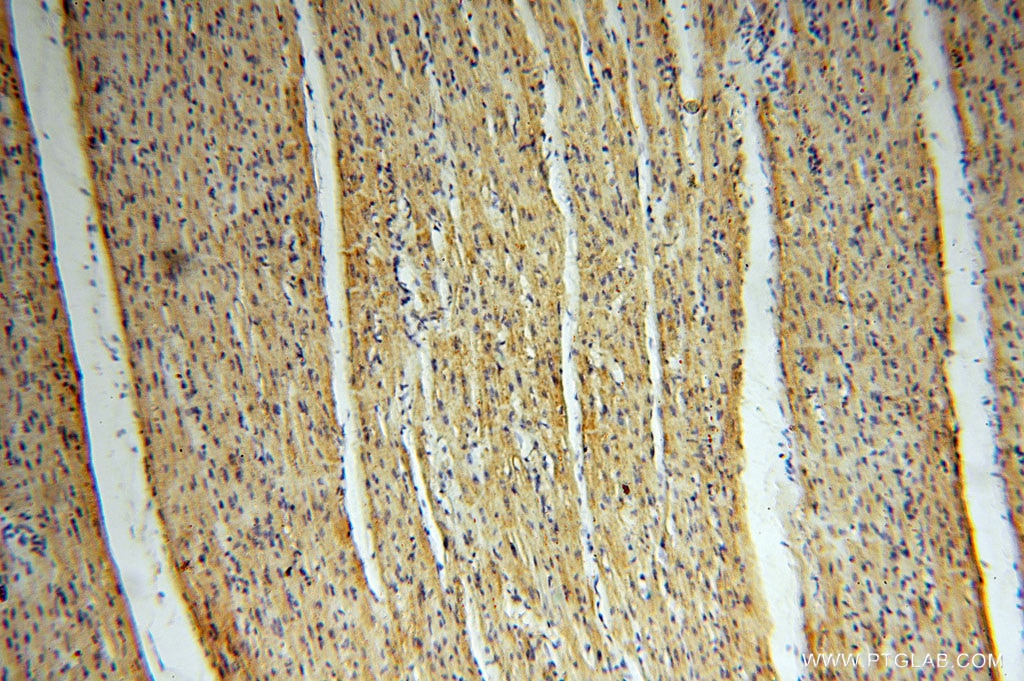 MECR IHC Immunohistochemical 14932-1-AP MECR Antibody CGI-63; FASN2B; NRBF1