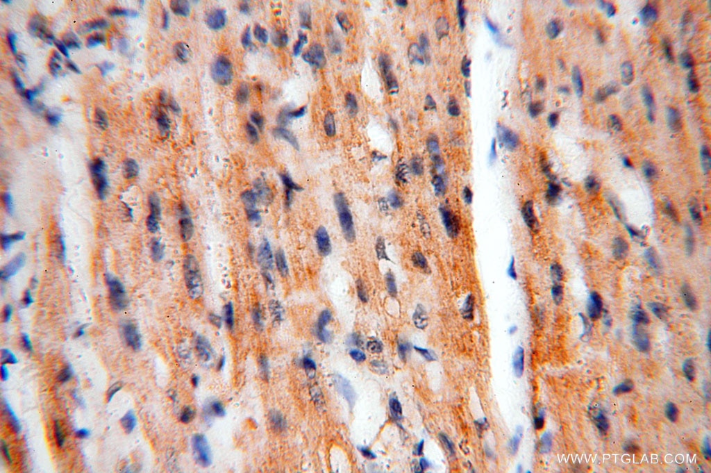 MECR IHC Immunohistochemical 14932-1-AP MECR Antibody CGI-63; FASN2B; NRBF1