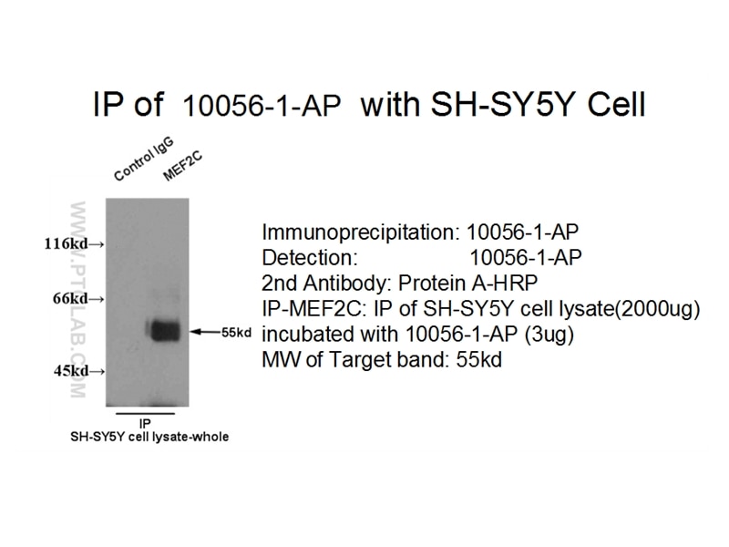 MEF2C IP 10056-1-AP MEF2C Antibody 
