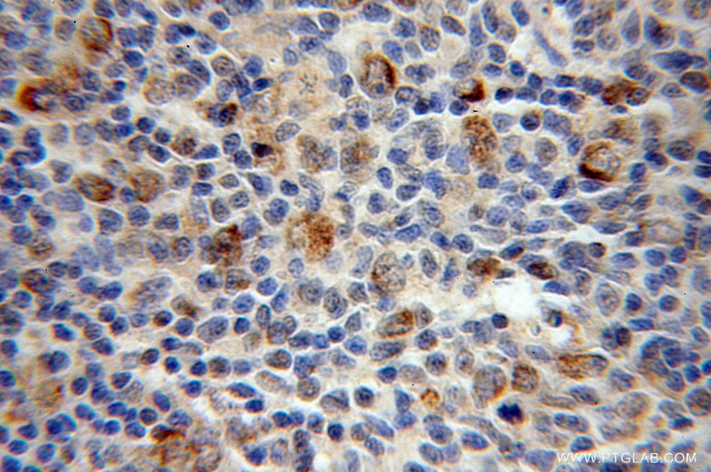 MEF2C IHC Immunohistochemical 10056-1-AP MEF2C Antibody 