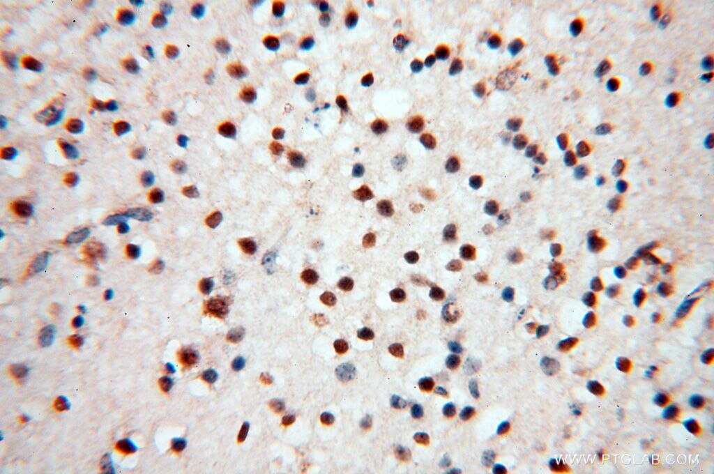 MEF2C IHC Immunohistochemical 18291-1-AP MEF2C Antibody 