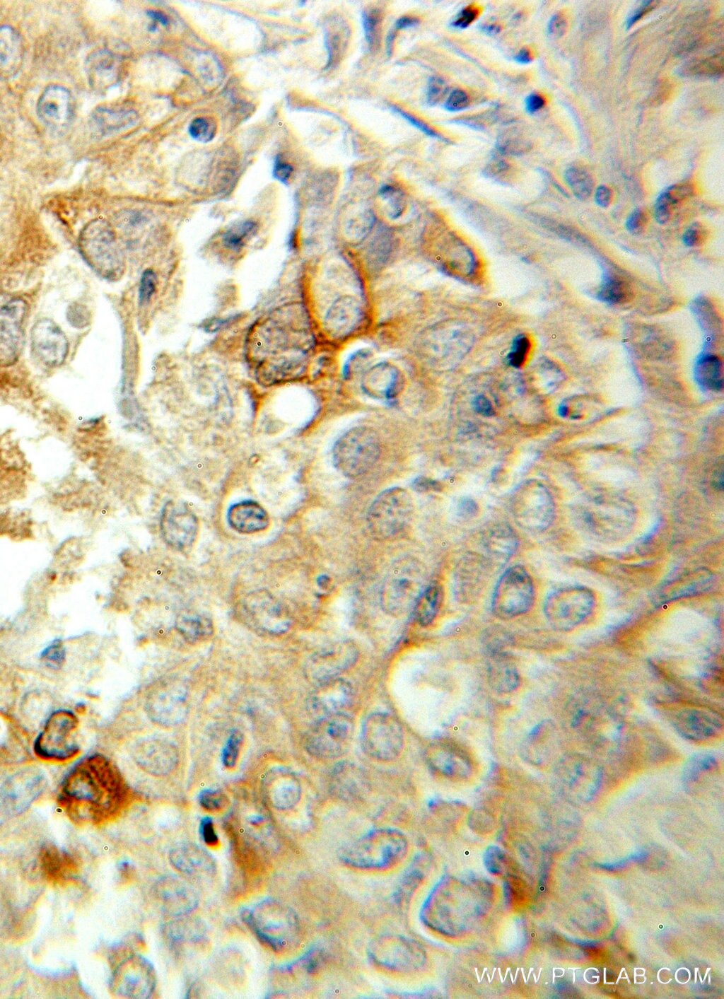 MGP IHC Immunohistochemical 10734-1-AP MGP Antibody GIG36; MGLAP; NTI