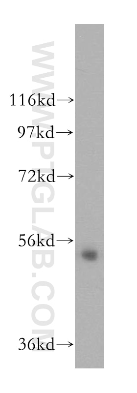 MIER3 western blot WB 17543-1-AP MIER3 Antibody DKFZp686L09111; DKFZp781G1119; DKFZp781I1119; FLJ35954