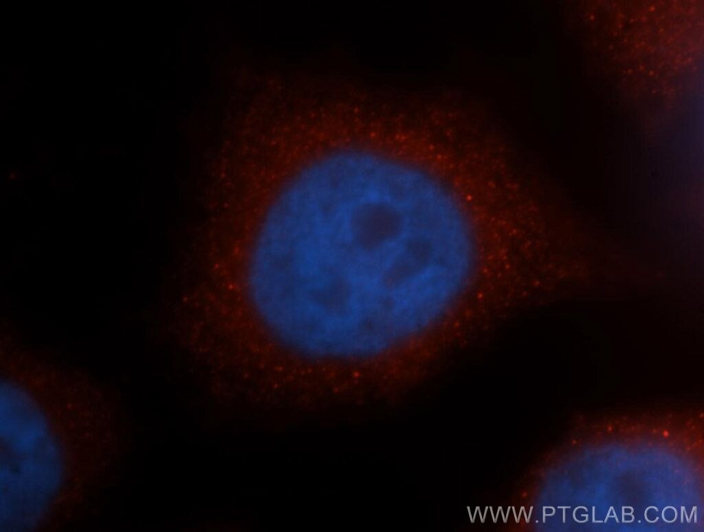 MLPH Immunofluorescence IF 10338-1-AP MLPH Antibody MGC2771; MGC59733; SLAC2-A