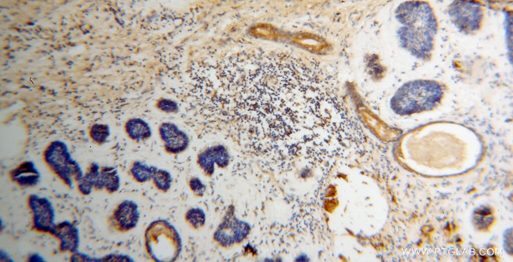 MLPH IHC Immunohistochemical 10338-1-AP MLPH Antibody MGC2771; MGC59733; SLAC2-A