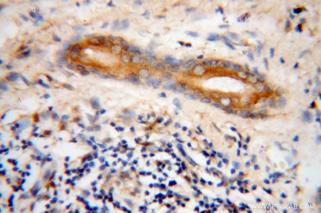 MLPH IHC Immunohistochemical 10338-1-AP MLPH Antibody MGC2771; MGC59733; SLAC2-A