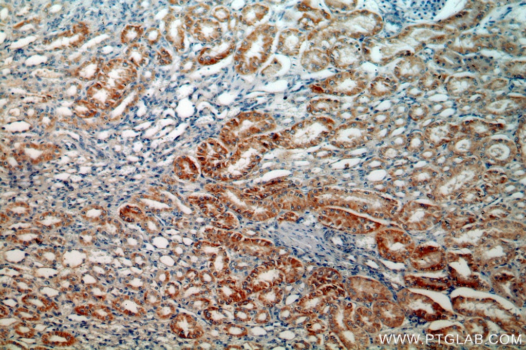 MLYCD IHC Immunohistochemical 15265-1-AP MLYCD Antibody MCD; MGC59795