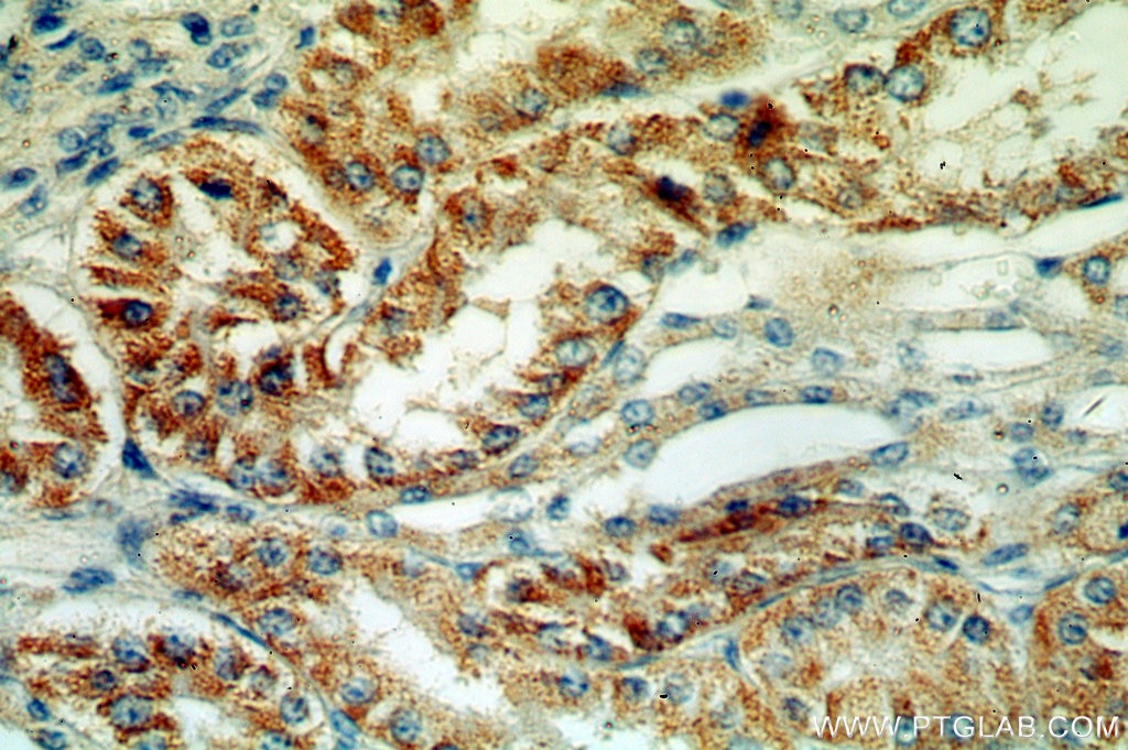 MLYCD IHC Immunohistochemical 15265-1-AP MLYCD Antibody MCD; MGC59795