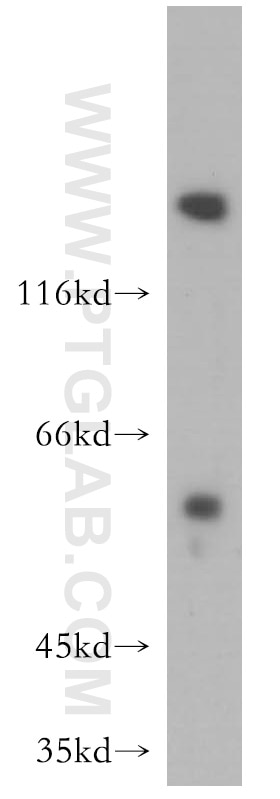 MMP1 western blot WB 10371-2-AP MMP1 Antibody MMP1;CLG;CLGN ;