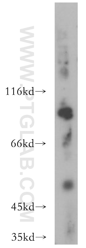 MMP13 western blot WB 18165-1-AP MMP13 Antibody CLG3