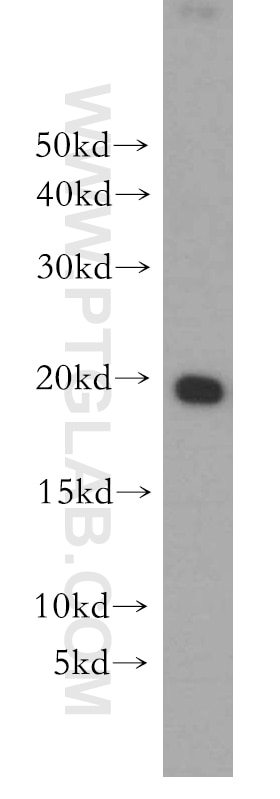 MCF7 cells were subjected to SDS PAGE followed by western blot with 10695-1-AP(MPHOSPH6 Antibody) at dilution of 1:400 MPHOSPH6 western blot WB 10695-1-AP MPHOSPH6 Antibody MPP; MPP-6; MPP6