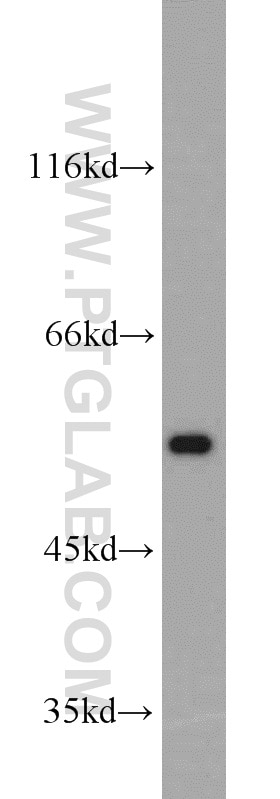 MPP6 western blot WB 11575-1-AP MPP6 Antibody PALS2; VAM-1; VAM1; p55T