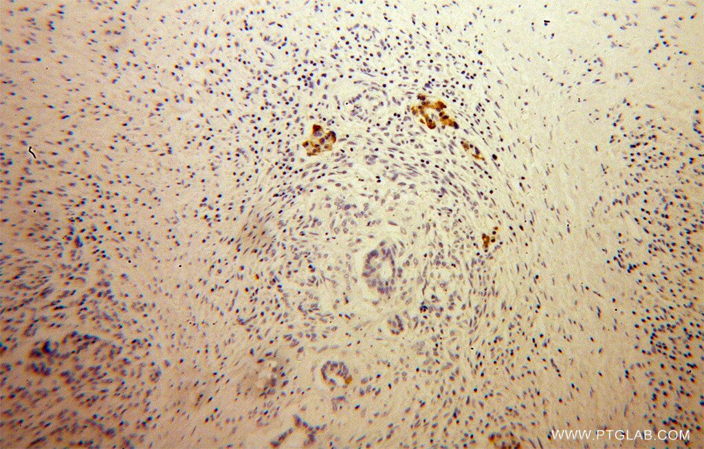 MPV17 IHC Immunohistochemical 10310-1-AP MPV17 Antibody SYM1