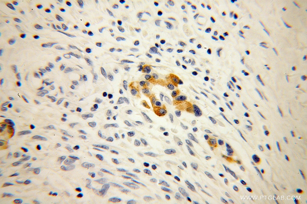 MPV17 IHC Immunohistochemical 10310-1-AP MPV17 Antibody SYM1