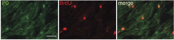 MPZ,P0 IF 10572-1-AP MPZ,P0 Antibody CHM; CMT1; CMT1B; CMT2I; CMT2J; CMT4E; CMTDI3; DSS; HMSNIB; MPP; P0