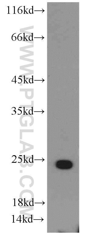 HepG2 cells were subjected to SDS PAGE followed by western blot with 15989-1-AP(MRPS26 Antibody) at dilution of 1:1000 MRPS26 western blot WB 15989-1-AP MRPS26 Antibody C20orf193; GI008; MRP-S13; MRP-S26; MRPS13; NY-BR-87; RPMS13; dJ534B8.3